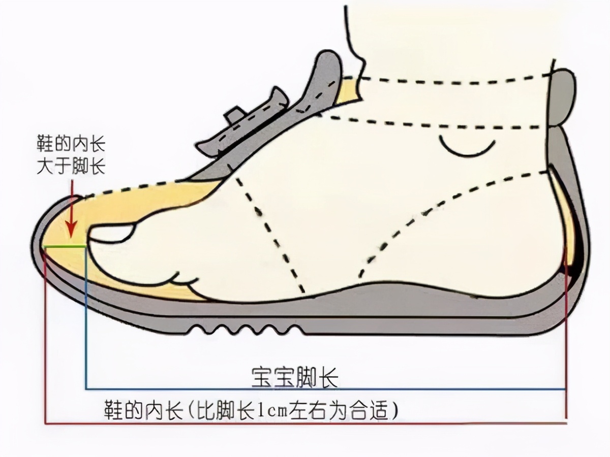 儿童鞋怎么选防止扁平足,扁平足儿童应该穿软底鞋还是硬底