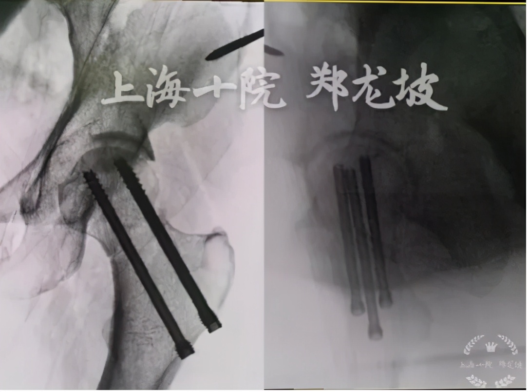 上海十院骨科手术量,上海骨科手术机器人