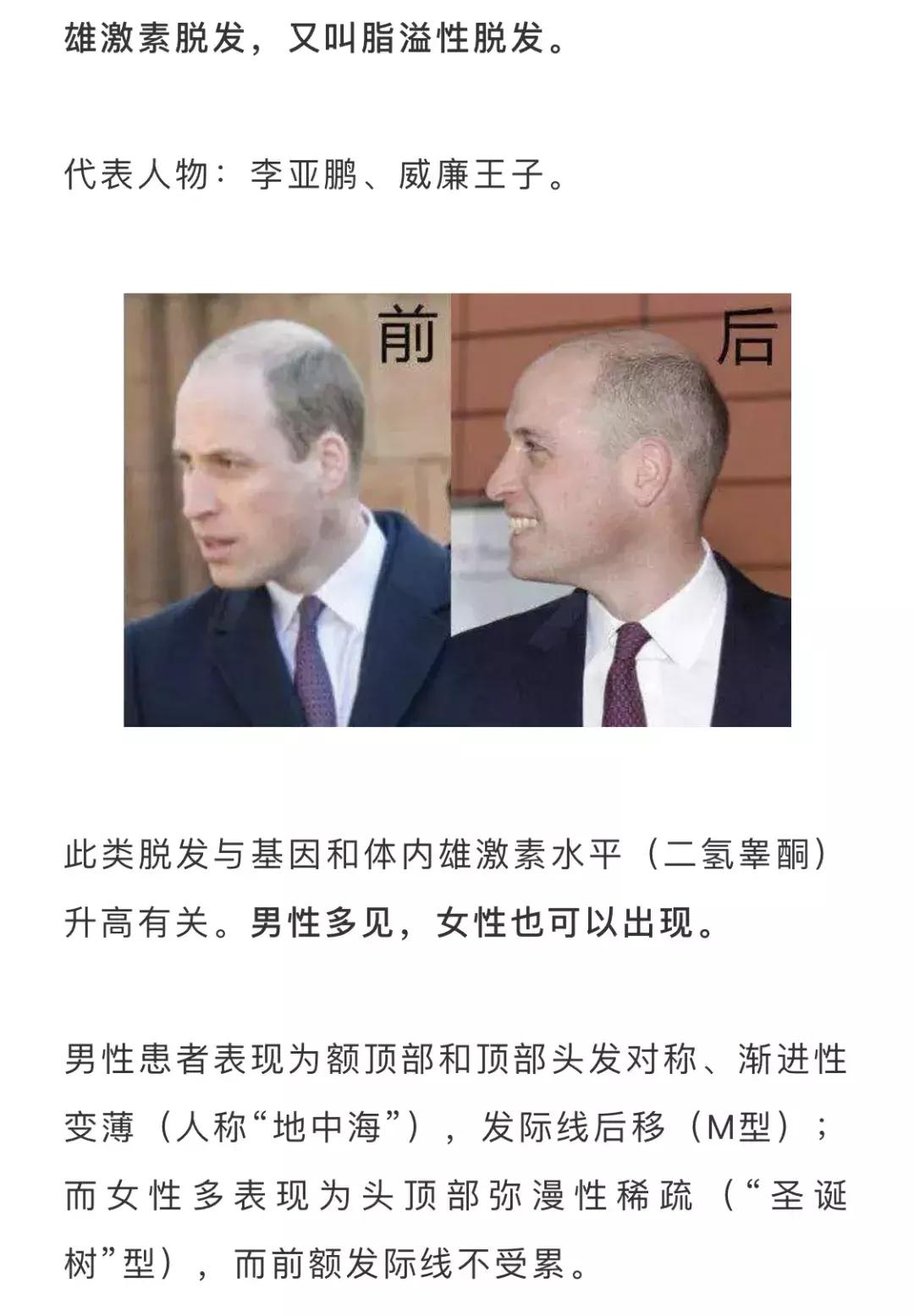 严重脱发快秃了怎么办,第一批90后秃头怎么办