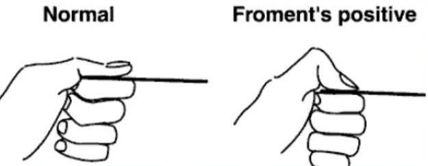 趴在床上玩手机胳膊麻,躺床上玩手机导致手麻头晕