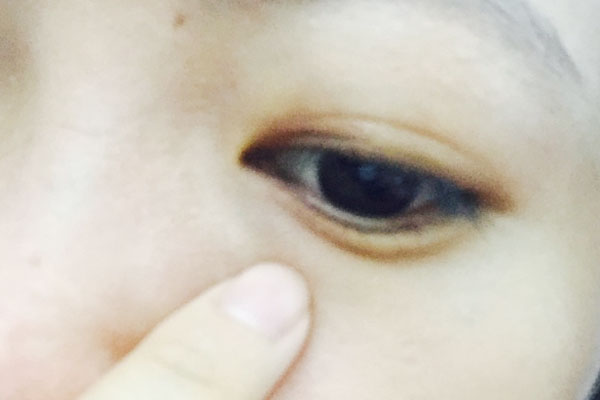 眼皮跳动是什么原因引起的,眼皮不定时跳是什么原因