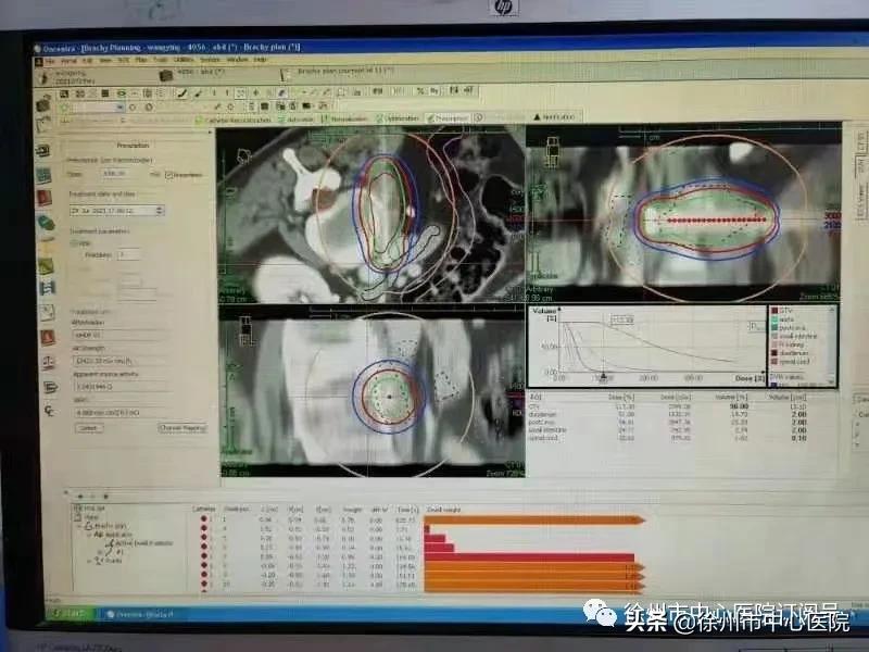 隐形的手术刀,隐藏式手术刀