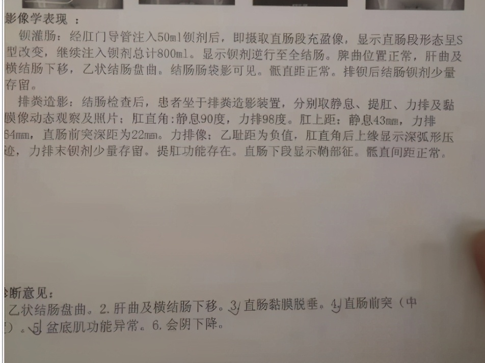 脱肛补中益气汤配方,吃补中益气丸一年能治好宝宝脱肛吗