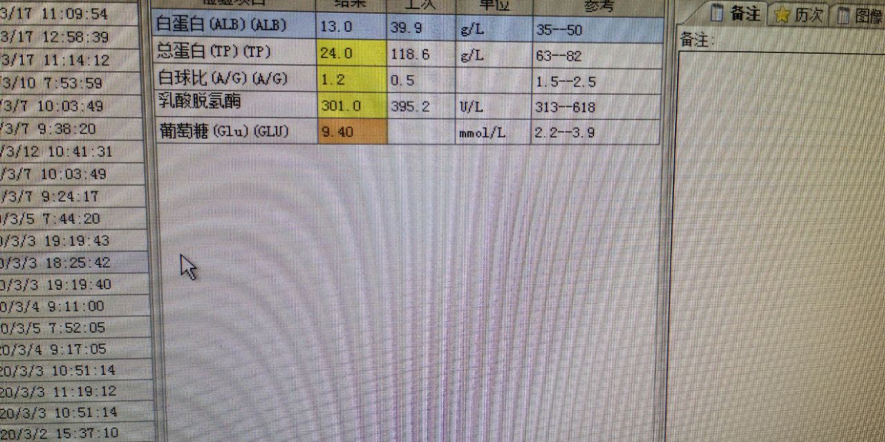 中西医结合治疗原因不明肠梗阻、腹水转氨酶明显升高病案一例！