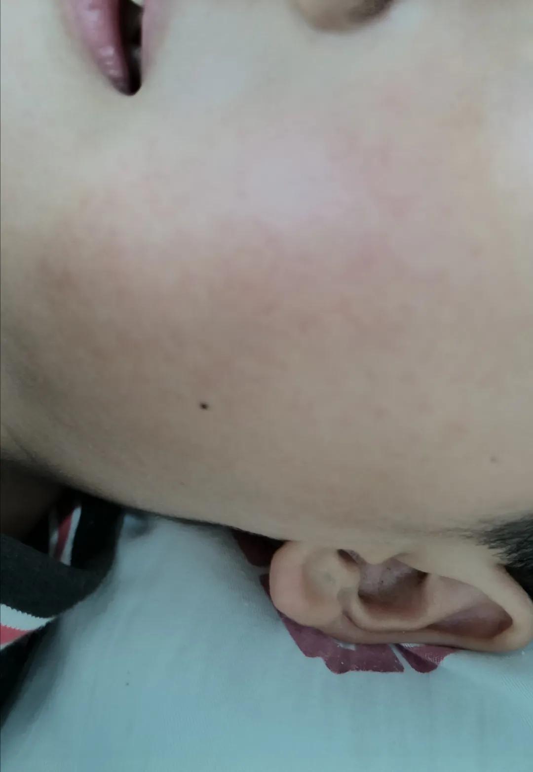 肝功能正常肝质地不均脾肿大,脾肿大肝功能异常血小板减少