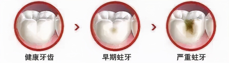 牙齿烂了一大半不补可以吗,牙齿全部烂了能不做牙冠吗