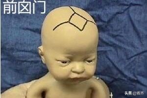 婴儿囟门有点小检查头围正常,1到2岁宝宝前囟门参数