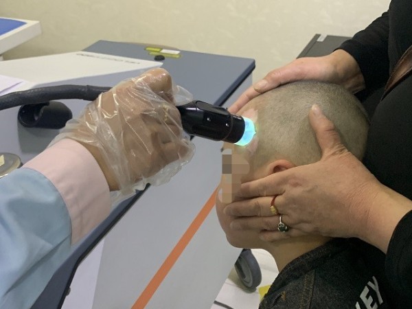 治好白癜风要注意这4项标准,治疗白癜风需要多久的时间