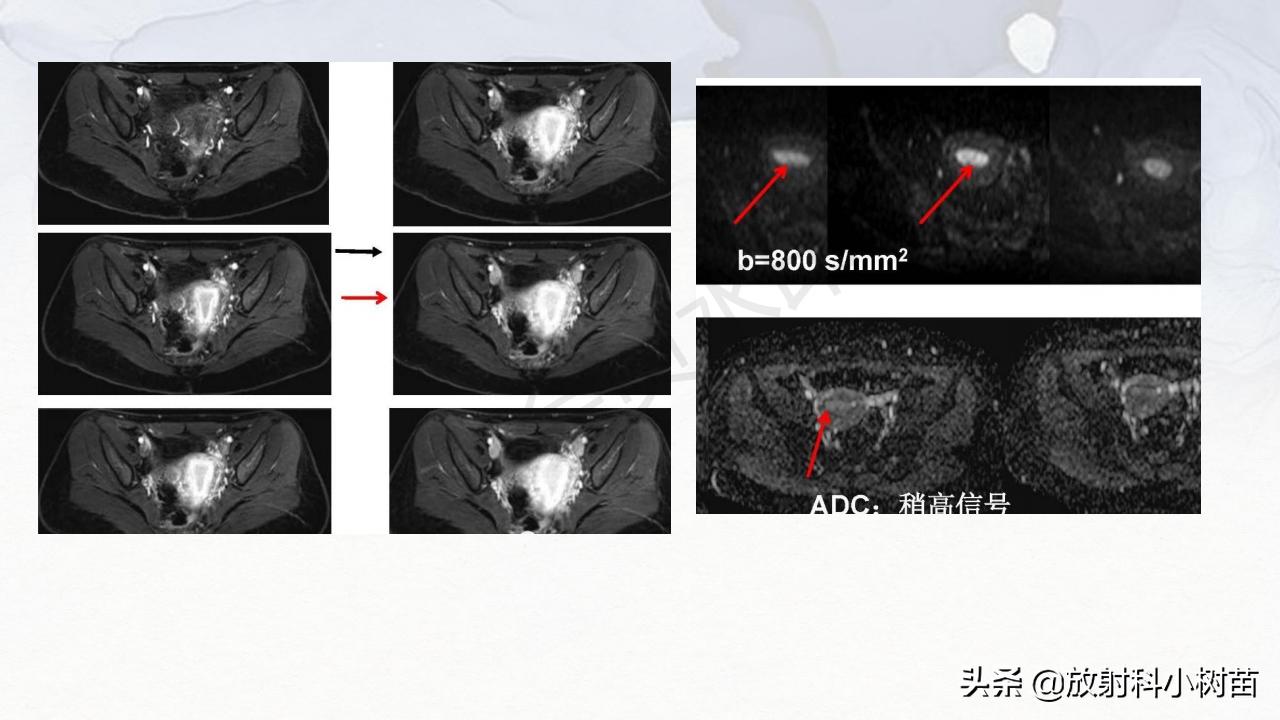 女性盆腔mri解剖图谱,泌尿生殖系统x线解剖
