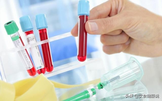 血常规检查要注意哪几个指标,血常规检查有三个指标要注意