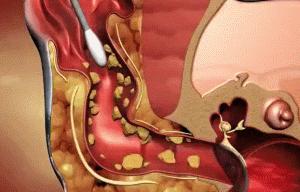 猫咪洗耳朵很不配合怎么办,生理盐水可以给猫咪洗耳朵吗