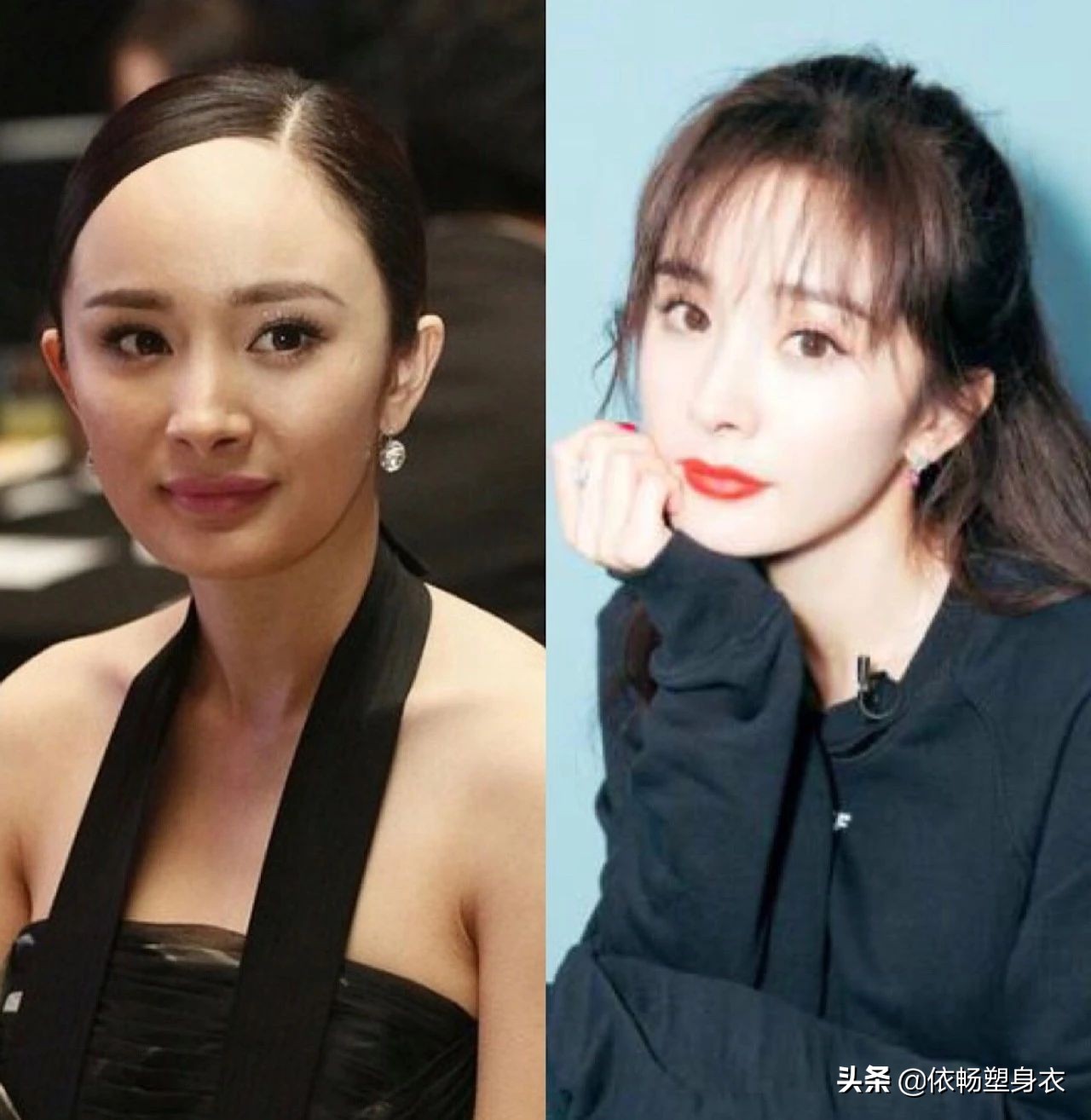 发际线高怎么挽救男生头发,怎么防止发际线后移秃头