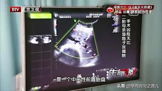 孕早期怎么知道是前置胎盘,孕早期能看出前置胎盘吗