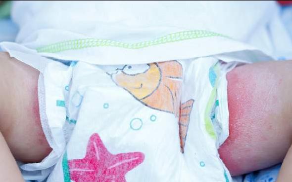 宝宝红屁屁处破皮护理,初生婴儿红屁屁怎么护理