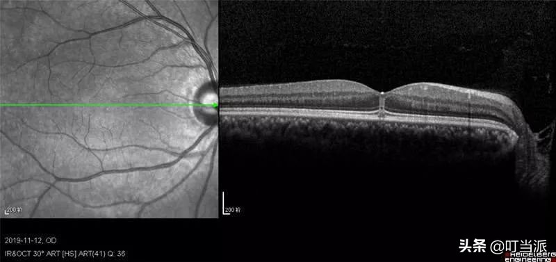 小朋友不能玩激光笔容易伤害眼睛,激光笔是否真的能损害孩子的眼睛