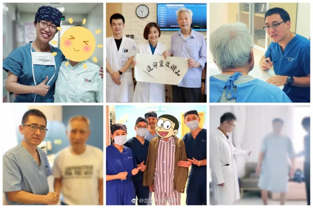 静脉曲张老年人手术,老年人静脉曲张要不要做手术