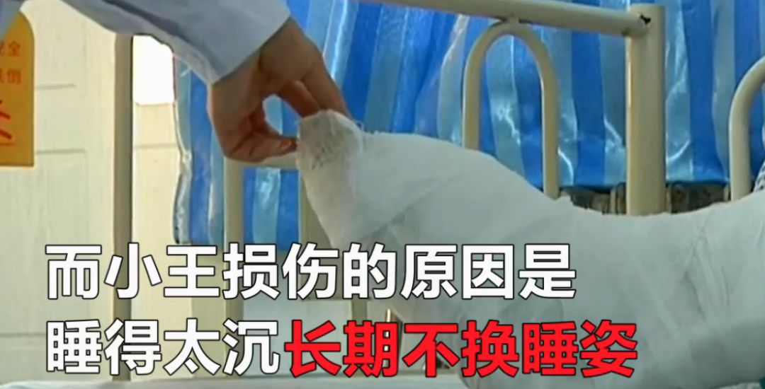 男孩床上玩游戏后睡觉，醒来时小腿麻木，检查发现是腓走神经损伤