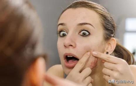 鼻子长痘痘怎么快速消除,鼻子长痘痘怎么办最快最有效