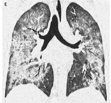 加热对维生素e的影响,维生素e加热的后果