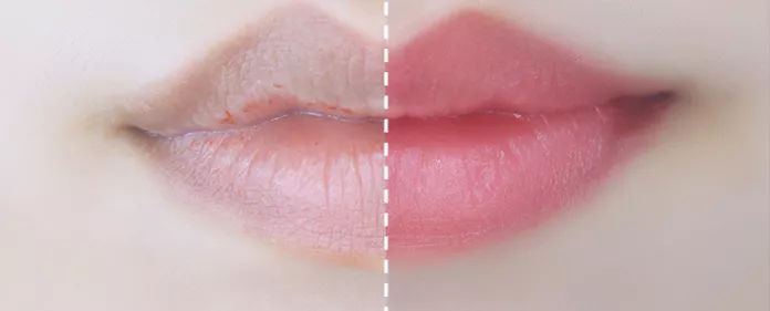 嘴唇不再干燥起皮温和润唇,秋冬唇干燥起皮