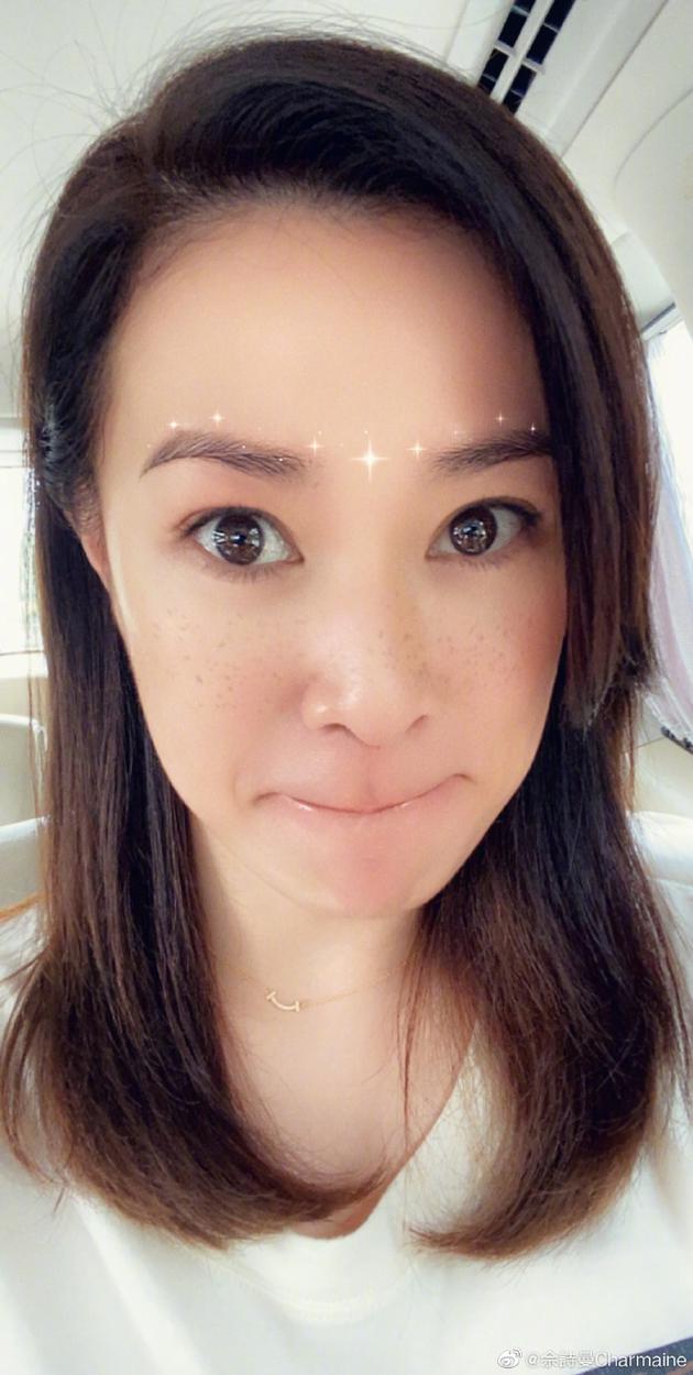 褐斑雀斑老年斑,老年斑褐斑晒斑图片