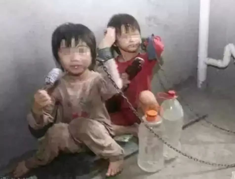 眼球被挖走了还能恢复么,眼球被挖走了还能恢复吗