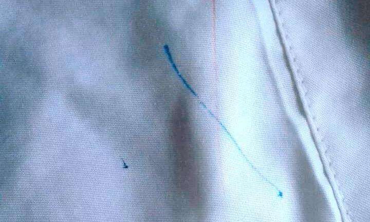 衣服从洗衣机洗出来有污渍怎么办,衣服顽固污渍洗不掉有什么好方法