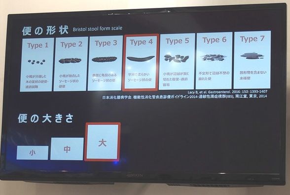 日本人对中国人做肛肠检查,日本人使用马桶