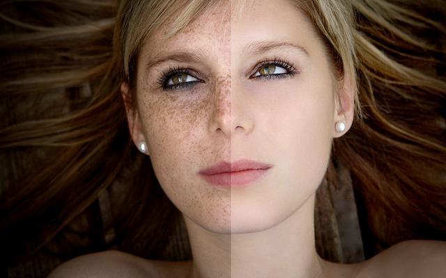 祛斑药膳食疗方,美白祛斑的食疗方