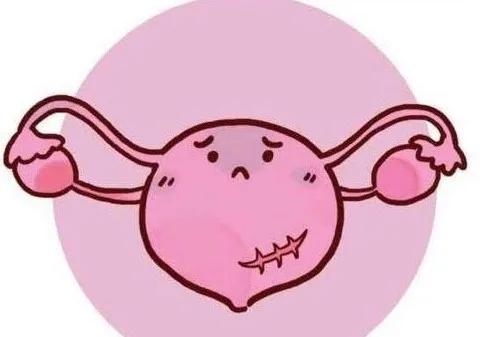 被劣质硅胶套毁掉的女孩,被节育环伤害的中国女人