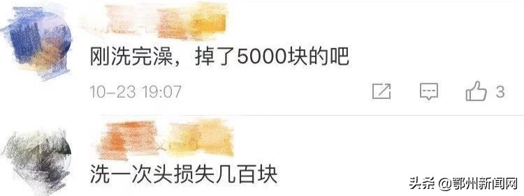 太秃了用什么假发片,秃头怎么办才能防脱发