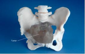 女士尿痛可能会是怎么回事？不一定都是感染