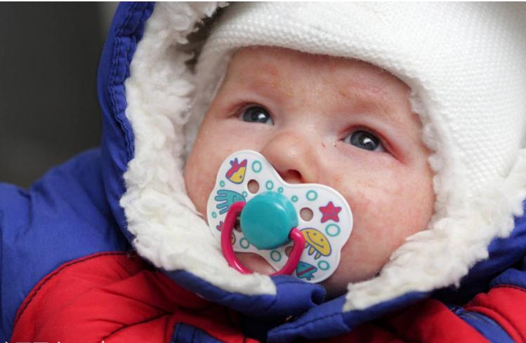 新生儿额头湿疹怎么消除又快又好,额头上湿疹黑斑要多长时间能消除