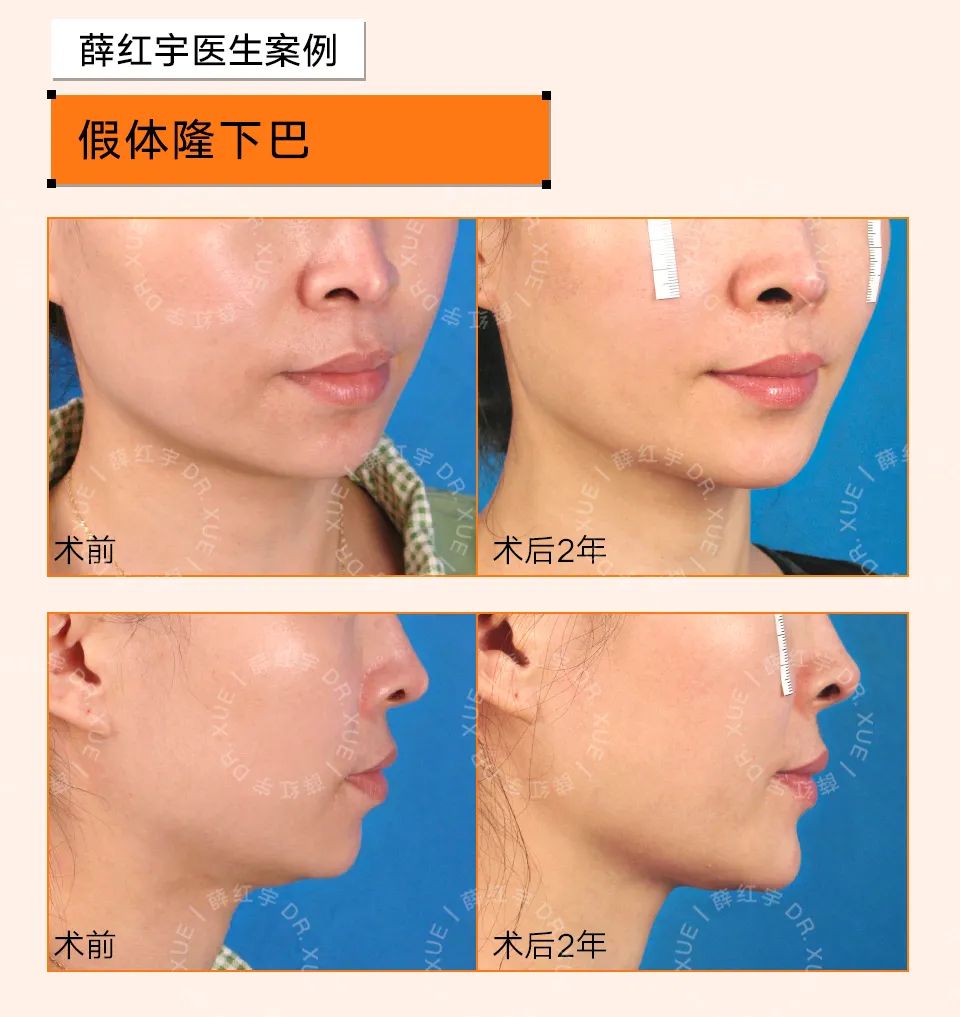 下巴宽厚的人,头尖下巴宽厚