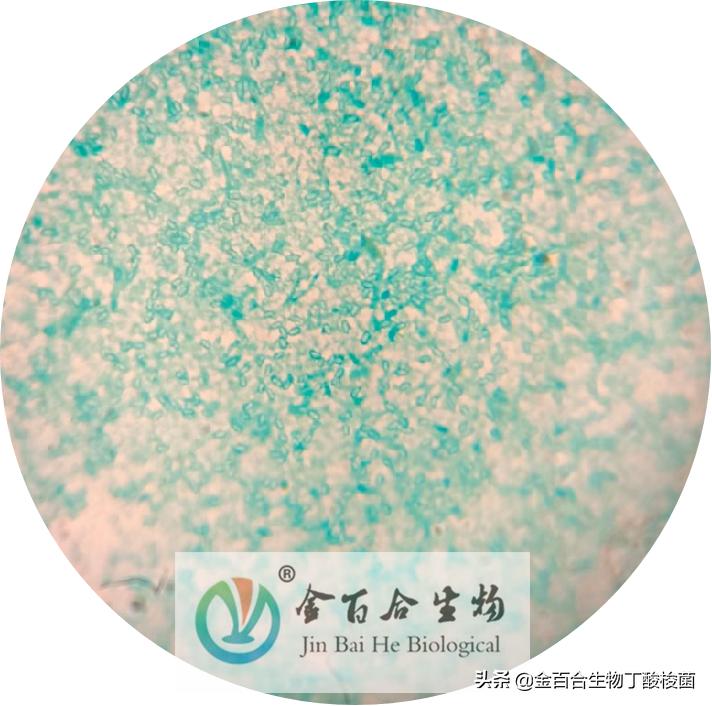 革兰氏染色显微镜下的图手绘,革兰染色用的显微镜是什么