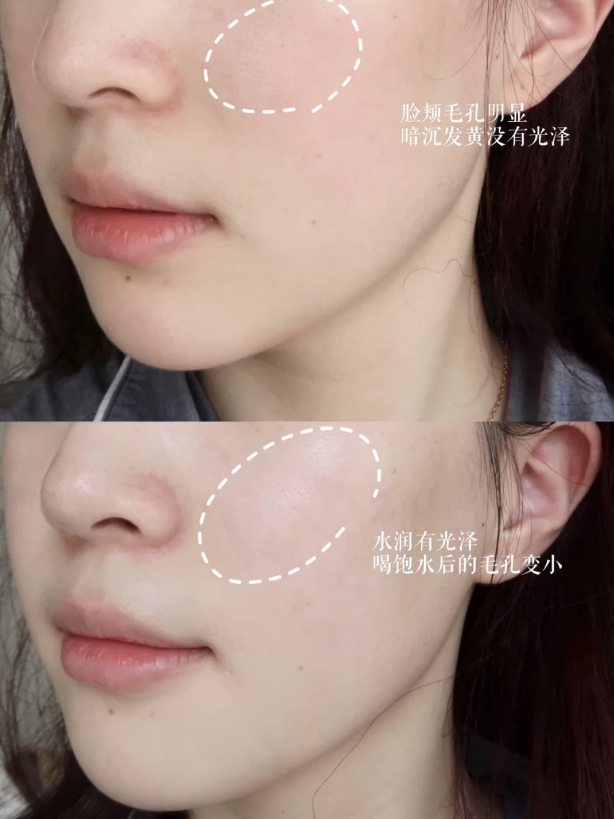 适合干皮痘痘肌的面霜海蓝之谜,海蓝之谜修护精华露适合干皮吗