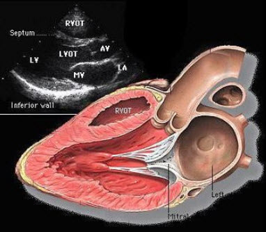 成人经胸超声心动图指南震荡盐水造影