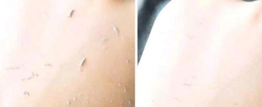 温和不刺激的护肤,温和去角质磨皮不伤肤