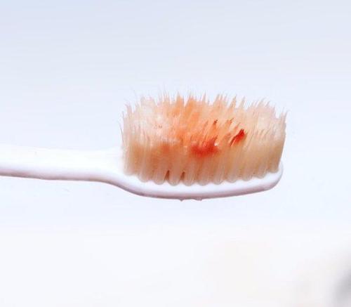 35岁男子查出肝癌一种水果不要吃,24岁小伙查出肝硬化