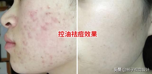 天然海藻面膜的功效与作用是什么,海藻面膜什么样子的好用