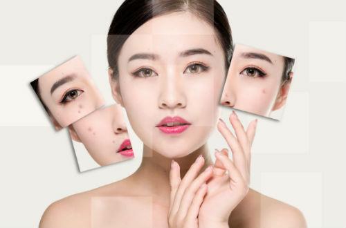 长斑有什么好办法能自己淡斑呢,长斑用什么药祛斑