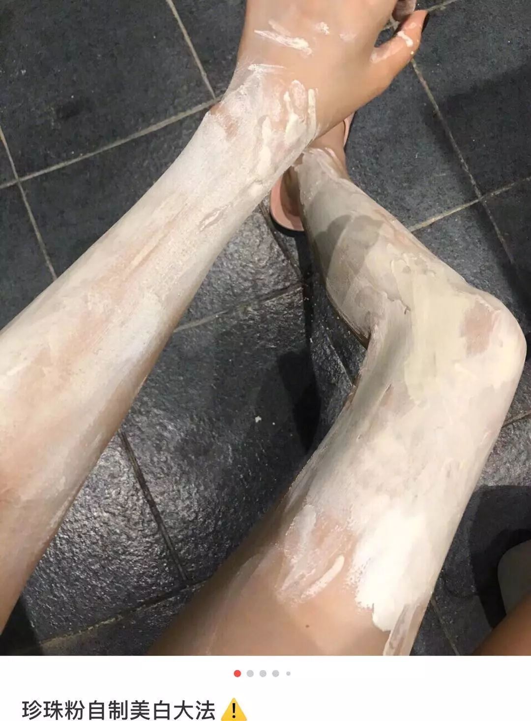 烂脸警告，这些膏求求你别再乱用啦！