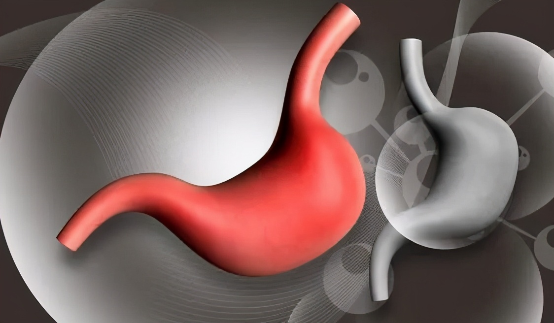 慢性糜烂性胃炎要注意什么,糜烂性胃炎需要多长时间才能治愈