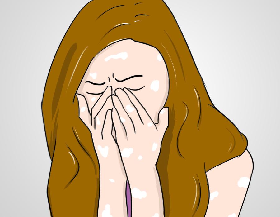 白癜风是常见的皮肤病吗,白癜风是很严重的皮肤病吗