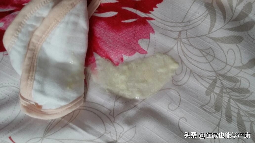 宝宝吐奶奶水豆腐渣,吐奶豆腐渣状20天宝宝