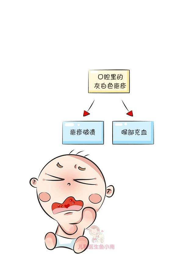 疱疹性咽峡炎怎么预防和减轻症状,疱疹性咽峡炎和手足口有什么差别