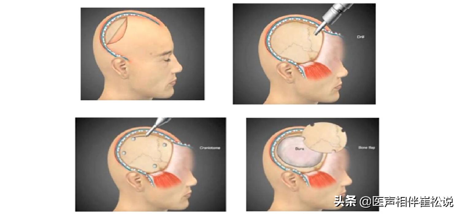 做好这几件事有助于康复,做好这四件事远离危险