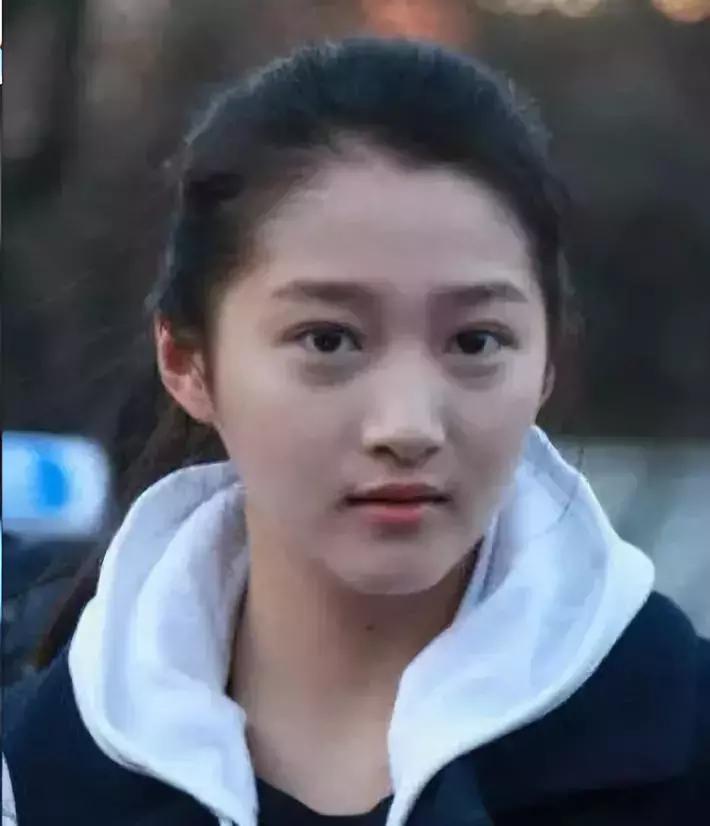 有眼袋太显老祛眼袋这里有妙招,有眼袋显老十岁一招教你消除