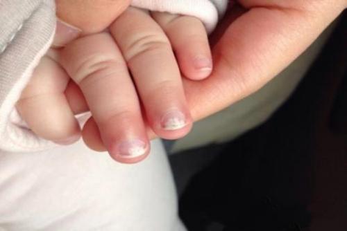 小孩缺锌要吃几个疗程,10岁孩子缺锌的症状及表现