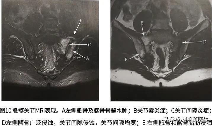 免疫相关不良妊娠诊断指南,免疫治疗不良妊娠的方法